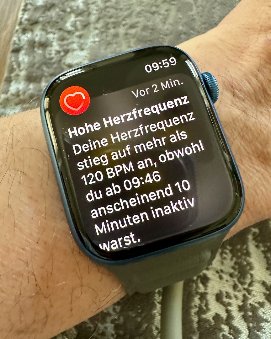 365 Tage mit der Smartwatch